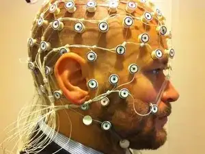 Electrodiagnostic (EEG and EMG)