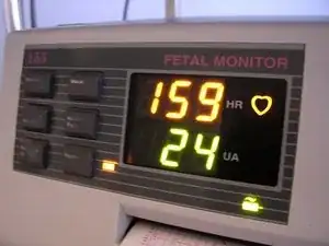 HP 8040A Fetal Monitor