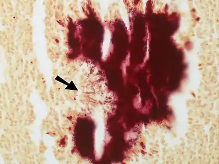 Thin Gram positive filamentous organisms seen at the periphery of the colony