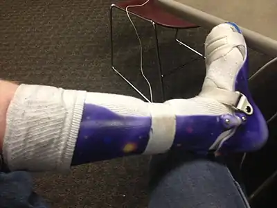 Ankle foot orthosis