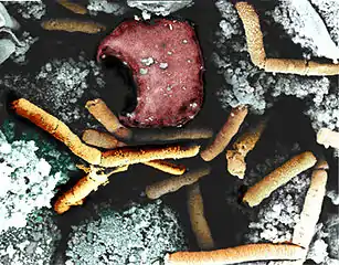 Color-enhanced scanning electron micrograph shows splenic tissue from a monkey with inhalational anthrax; featured are rod-shaped bacilli (yellow) and an erythrocyte (red)