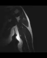 MRI mid-upper arm