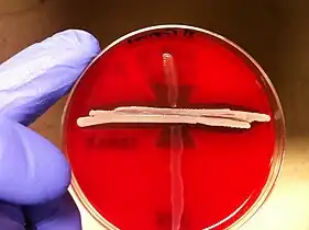 Positive CAMP test indicated by the formation of an arrowhead where Streptococcus agalactiae meets the Staphylococcus aureus (white middle streak)