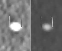 Measurement of a 5.6 mm large kidney stone in soft tissue versus skeletal CT window.