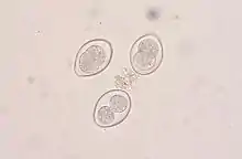 Coccidia oocysts in a fecal flotation from a cat. The cat was underweight and had diarrhea, showing signs of coccidiosis