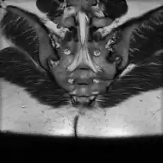 MRI