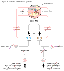 Shows the effect of the interruption of GnRH hormone release from the hypothalamus and the subsequent inability of the testes and ovaries to function correctly at puberty as seen in cases of KS/HH. In most cases of KS/HH the testes and ovaries are able to function correctly, but fail to do so because they have not had the correct hormonal signals.