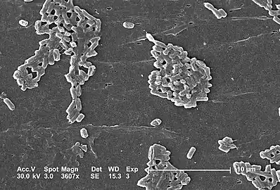 Escherichia coli is a Gram-negative bacterium that normally colonizes the digestive tract of most warm-blooded animals.One strain of E. coli, O157:H7, causes an estimated 73,000 cases of infection, and 61 deaths in the United States each year