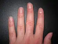 Human fingers and nails