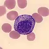 Immature granulocyte (myelocyte)