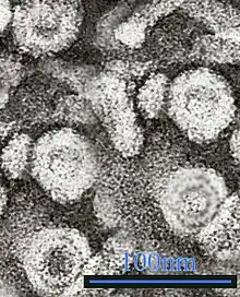 TEM micrograph showing hepatitis B virus virions