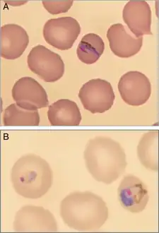 Microscopic aspect of Plasmodium knowlesi in a blood smear