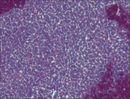 Gram positive bacteria  20X