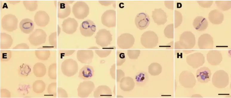 Giemsa-stained thin blood smears of human red blood cells infected with Plasmodium knowlesi