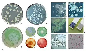 Pigment production, growth on cetrimide agar, the oxidase test, plaque formation and Gram stain.