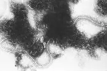 Electron micrograph of RSV