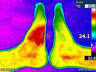 The left side of the image shows the ≈4 °C (7 °F) temperature increase (saturated red zone) caused by a bee sting after about 28 hours.