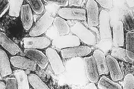 TEM micrograph of "Indiana vesiculovirus" particles