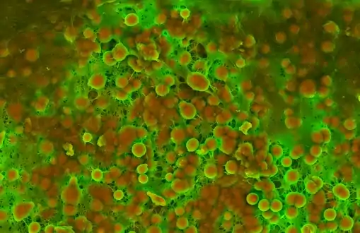 Density-Dependent Colour Scanning Electron Micrograph SEM (DDC-SEM) of cardiovascular calcification, showing in orange calcium phosphate spherical particles (denser material) and, in green, the extracellular matrix (less dense material)