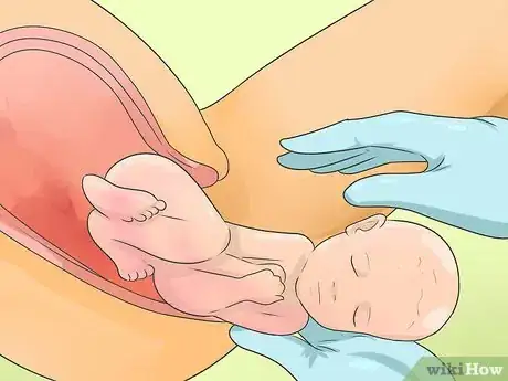 Immagine titolata Deliver a Baby Step 10