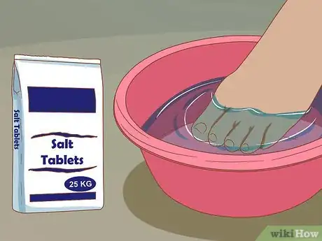Immagine titolata Help a Toenail Grow Back Quickly Step 10