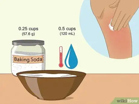 Immagine titolata Prevent Ingrown Hairs After Waxing Using Home Remedies Step 8