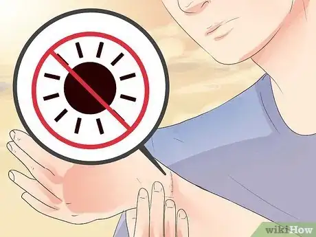 Immagine titolata Get Rid of a Cut Step 9
