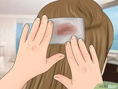 Immagine titolata Evaluate for Head Injuries During First Aid Step 12