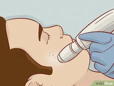 Immagine titolata Close Blackhead Holes Step 11