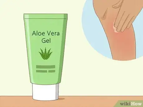 Immagine titolata Prevent Ingrown Hairs After Waxing Using Home Remedies Step 9