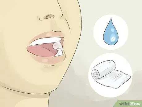 Immagine titolata Recover after Wisdom Teeth Surgery Step 3
