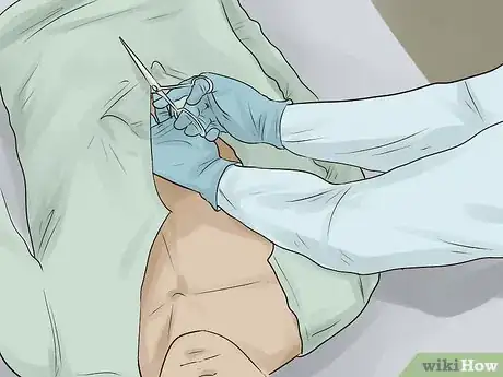 Immagine titolata Embalm Step 2