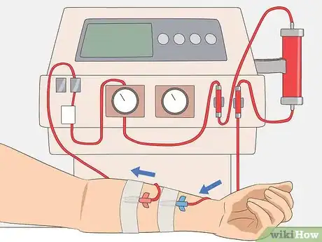 Immagine titolata Bring Down High Creatinine Levels Step 22