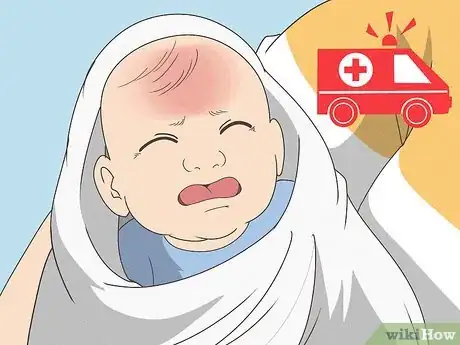 Immagine titolata Break a Fever in an Infant Step 1