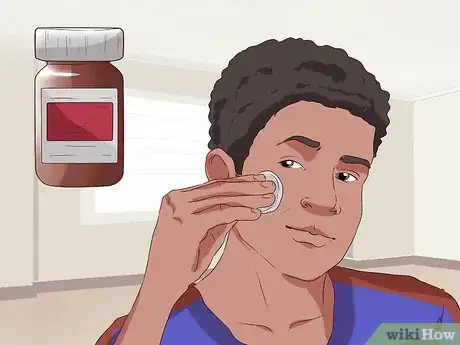 Immagine titolata Get Rid of Pimple Redness Overnight Step 9