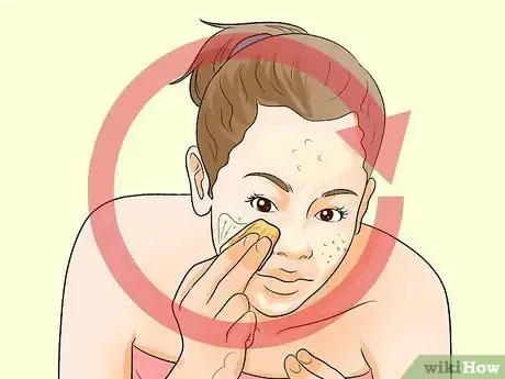 Immagine titolata Treat Acne With Banana Peels Step 6