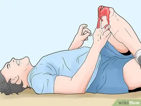Immagine titolata Treat an Open Fracture During First Aid Step 2