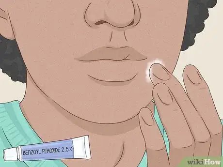 Immagine titolata Get Rid of a Zit Overnight Step 2