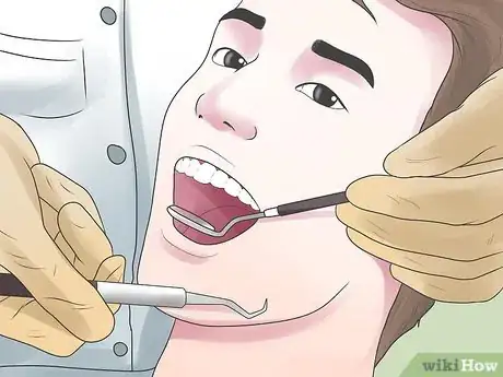 Immagine titolata Clean Your Teeth After Wisdom Teeth Removal Step 11