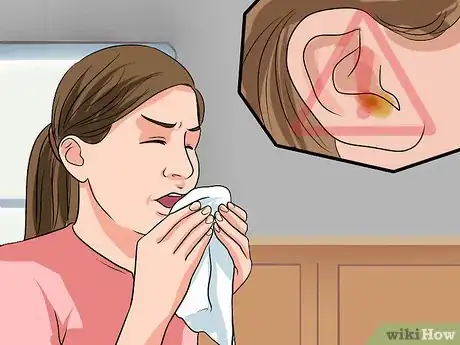 Immagine titolata Know if You Have Otitis Media Step 24