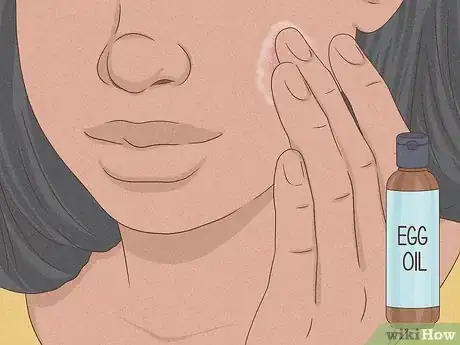 Immagine titolata Get Rid of a Zit Overnight Step 7