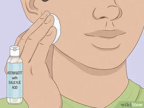 Immagine titolata Get Rid of a Zit Overnight Step 6