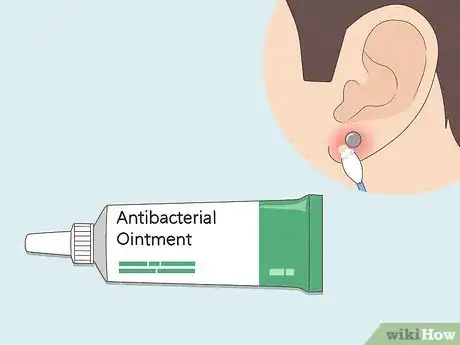 Immagine titolata Treat an Infected Ear Piercing Step 3