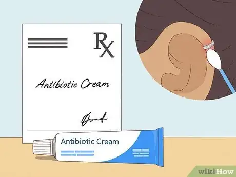 Immagine titolata Treat an Infected Ear Piercing Step 6