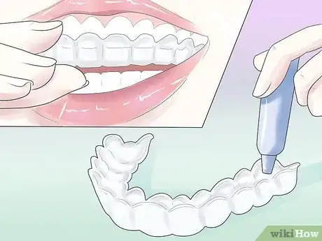 Immagine titolata Cope with Teeth Whitening Sensitivity Step 3