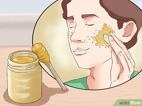 Immagine titolata Get Rid of Pimple Redness Overnight Step 1