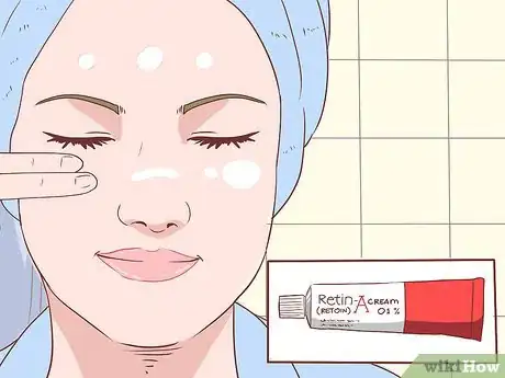 Immagine titolata Treat Acne (Teenage Girls) Step 15
