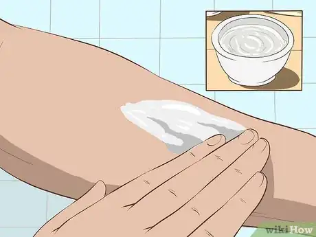 Immagine titolata Stop Mosquito Bites from Itching Step 6