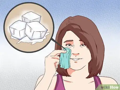 Immagine titolata Get Rid of Pimple Redness Overnight Step 2