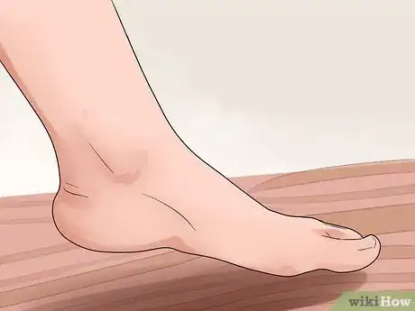 Immagine titolata Care for a Burst Blister Step 15